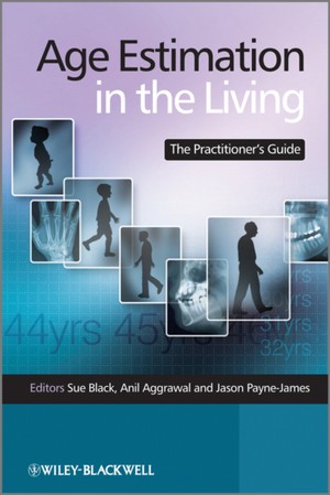 Age Estimation in the Living – The Practitioner′s Guide