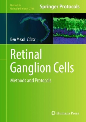 Retinal Ganglion Cells