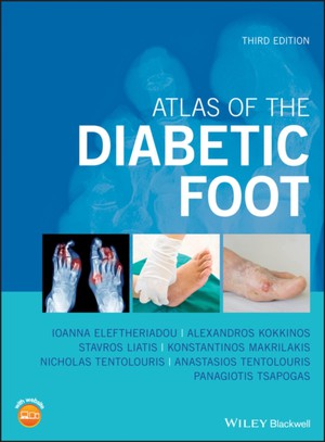 Atlas of the Diabetic Foot, 3rd Edition