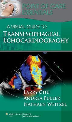 A Visual Guide to Transesophageal Echocardiography