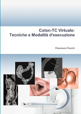 Colon-TC Virtuale