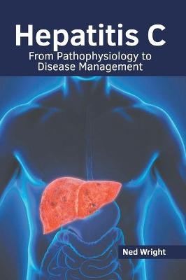 Hepatitis C: From Pathophysiology to Disease Management