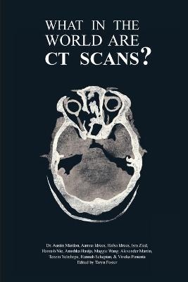 What in the World are CT Scans?