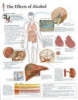 Effects of Alcohol Laminated Poster