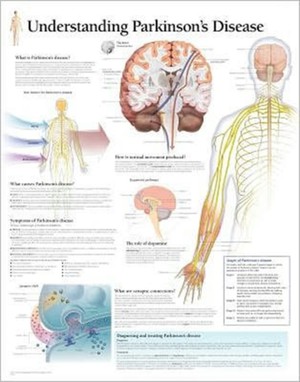 Understanding Parkinson's Paper Poster