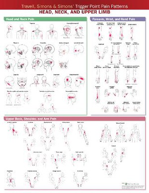 Travell, Simons & Simons’ Trigger Point Pain Patterns Wall Chart