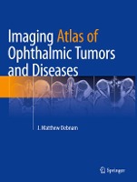 Imaging Atlas of Ophthalmic Tumors and Diseases