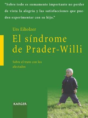 El síndrome de Prader-Willi