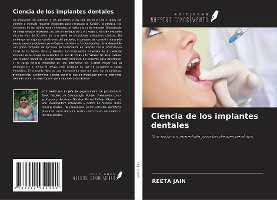 Ciencia de los implantes dentales