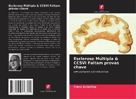 Esclerose Múltipla & CCSVI Faltam provas chave