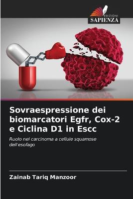 Sovraespressione dei biomarcatori Egfr, Cox-2 e Ciclina D1 in Escc