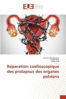 Reparation coelioscopique des prolapsus des organes pelviens