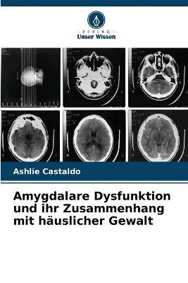 Amygdalare Dysfunktion und ihr Zusammenhang mit h�uslicher Gewalt