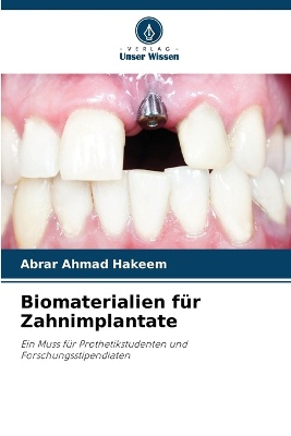 Biomaterialien f�r Zahnimplantate