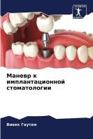 Маневр к имплантационной стоматологии
