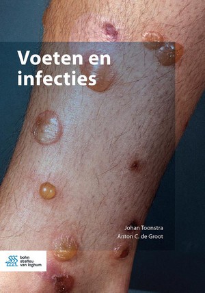 Voeten en infecties