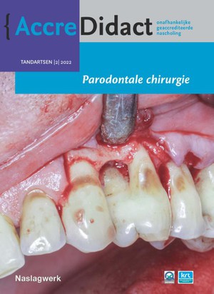Parodontale chirurgie