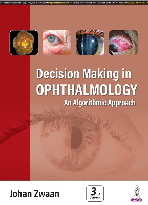 Decision Making in Ophthalmology
