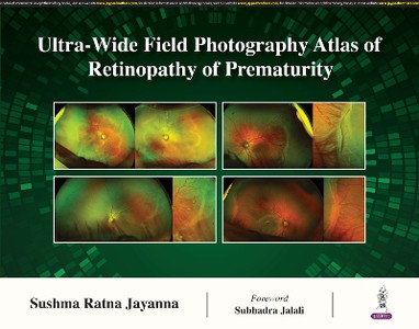 Ultra-Wide Field Photography Atlas of Retinopathy of Prematurity