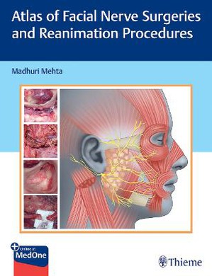 Mehta, Atlas of Facial Nerve Surgeries, A1, ePub