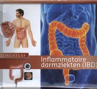 Inflammatoire darmziekten (IBD)