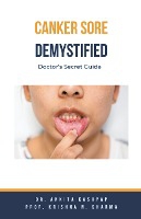 Canker Sore Demystified